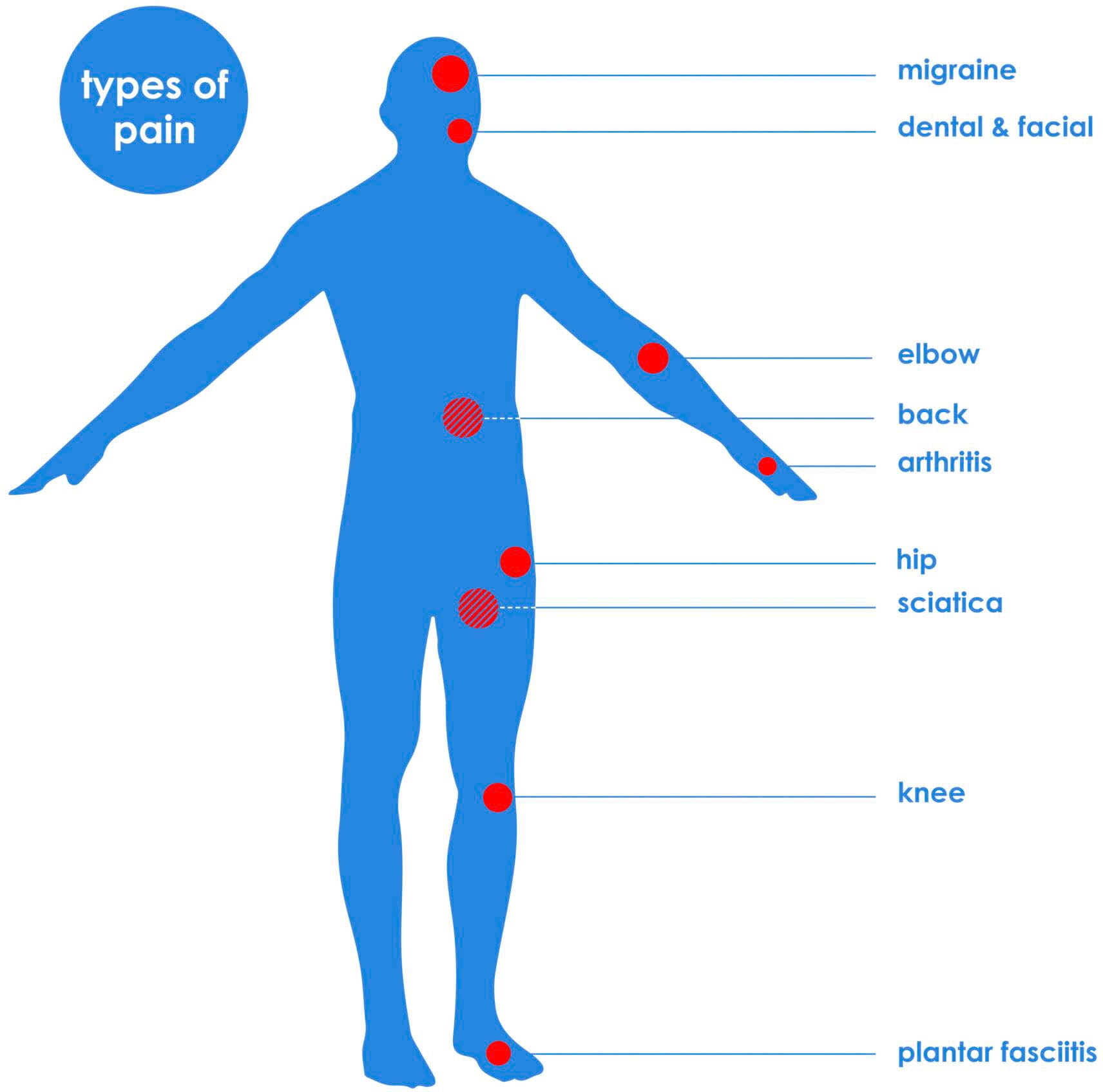 TensCare TENS-Gerät »Perfect TENS Schmerzlinderungsgerät«