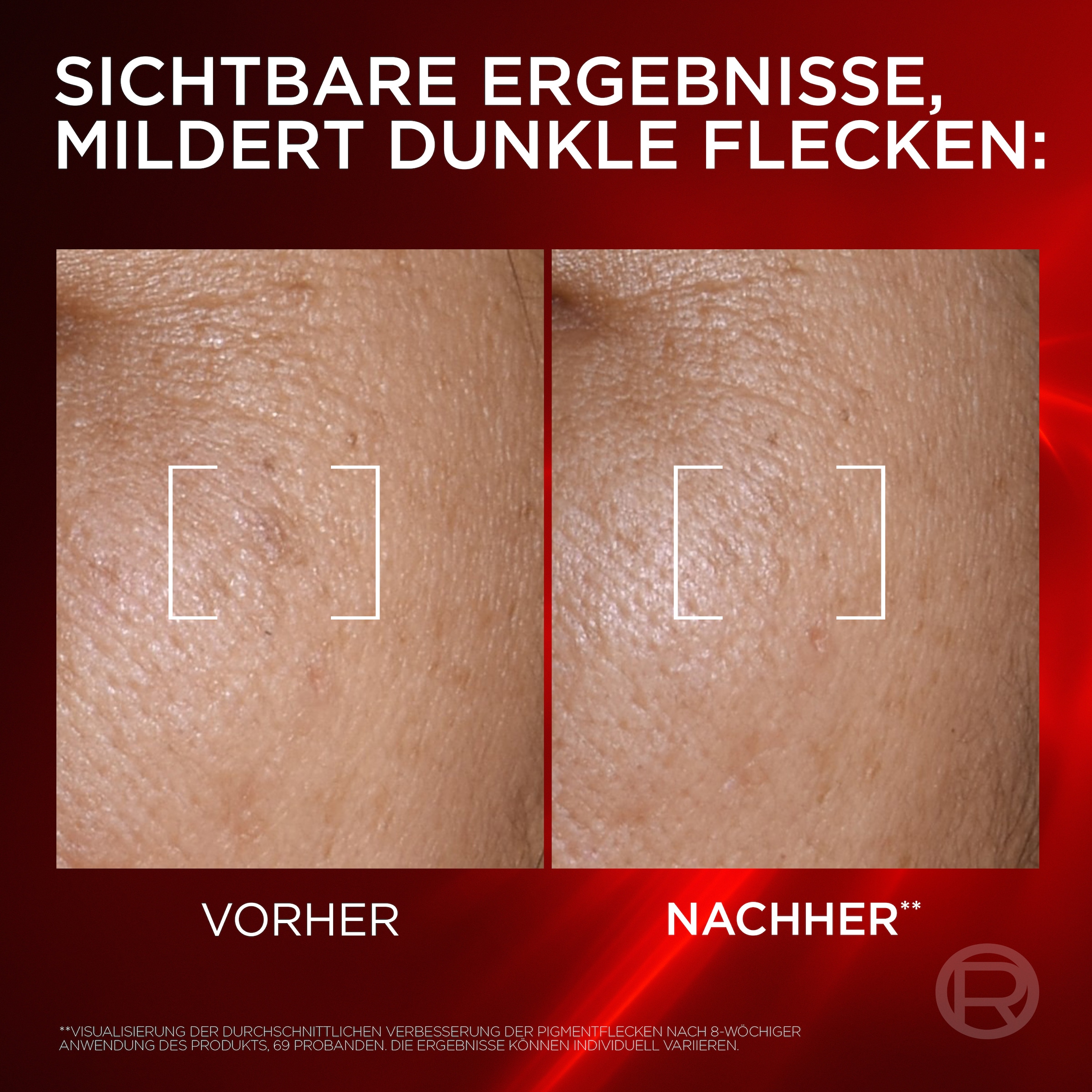 L'ORÉAL PARIS Gesichtsserum »REVITALIFT LASER ANTI-AGE CREMIGES SERUM«