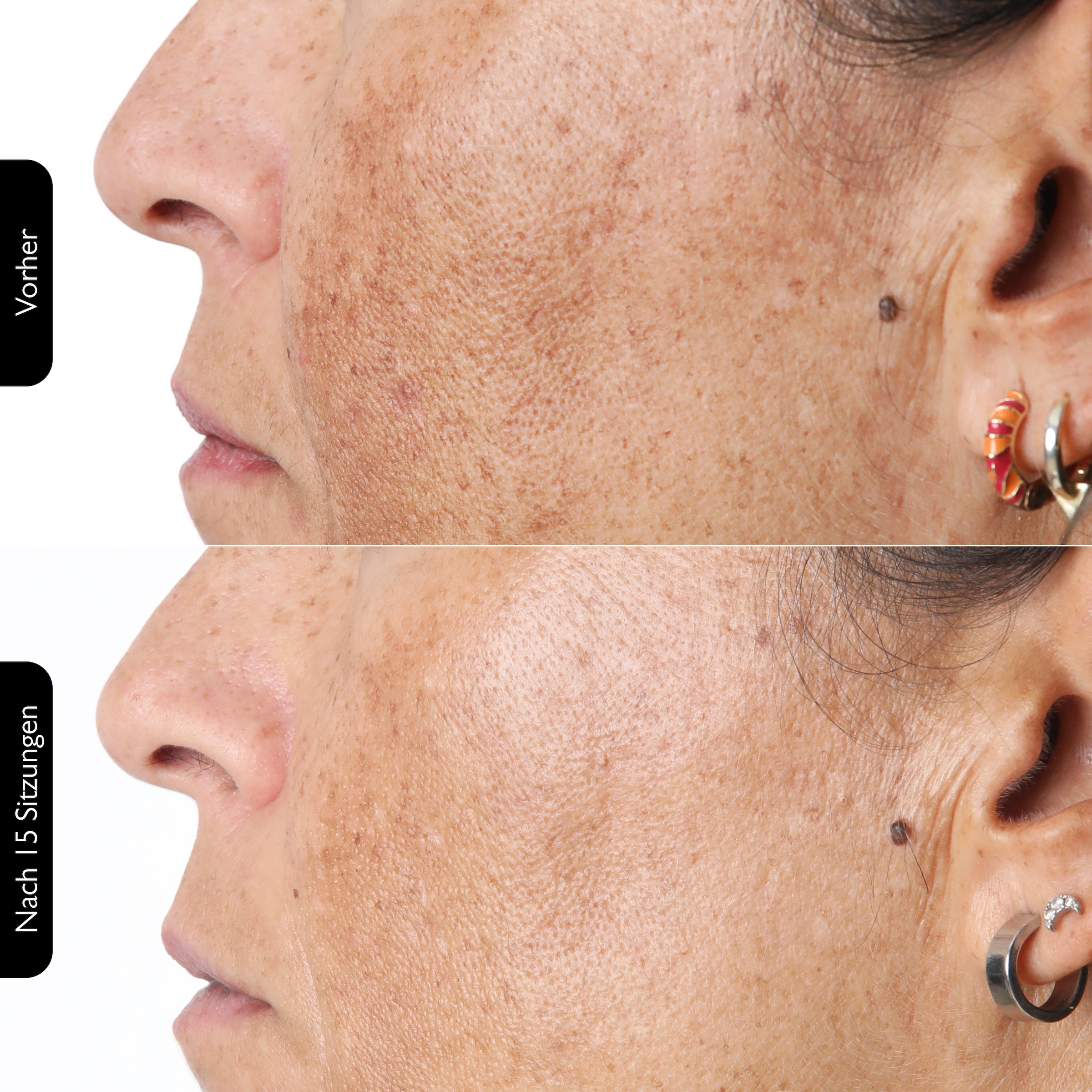 Silk'n Anti-Aging-Gerät »FaceTite Multiplatform«, Multifunktionsfähig