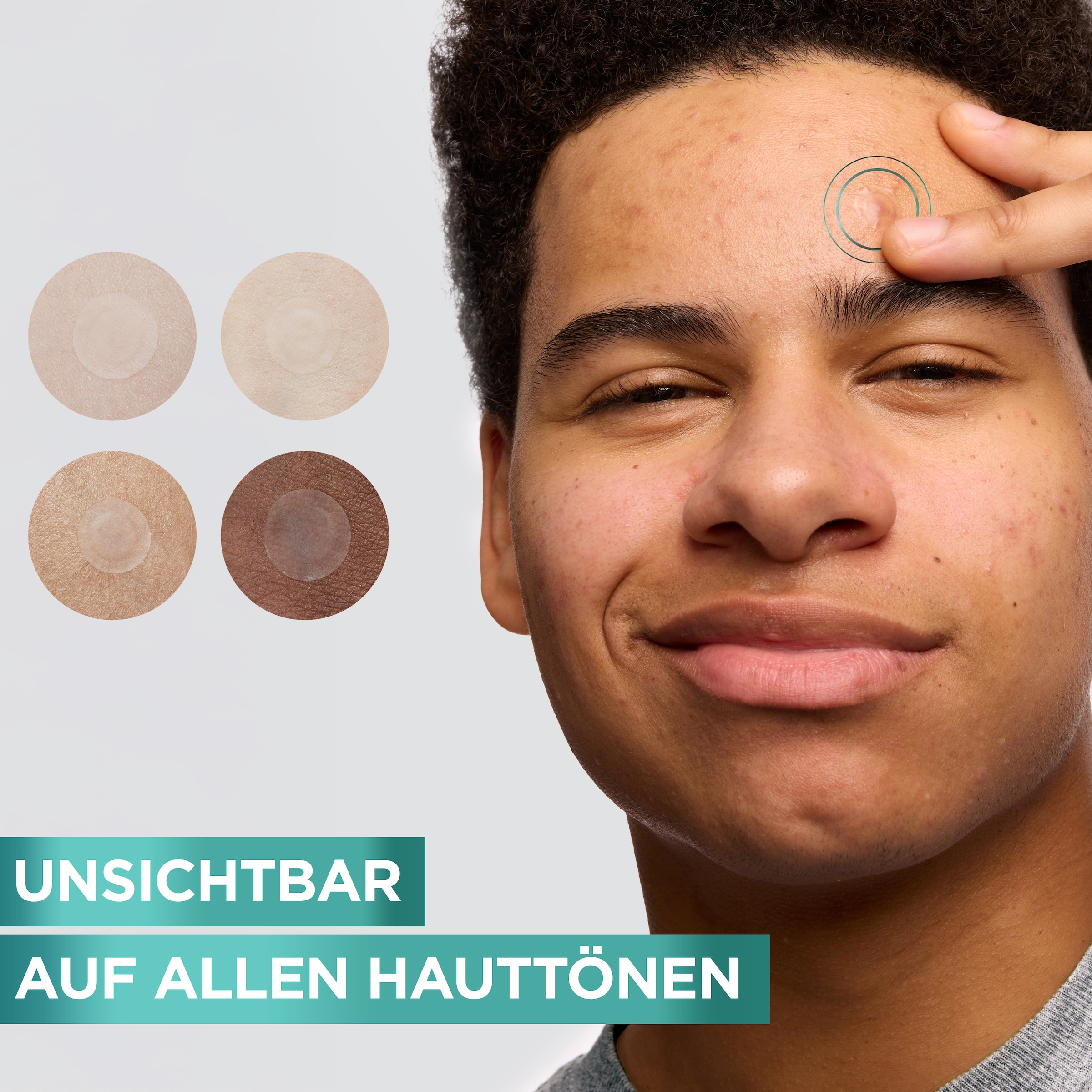 GARNIER Pflegestift »Garnier 8H Invisible Pimple Patch«, Flacht Pickel ab mit Hydrokolloid, keine Pickelmale.