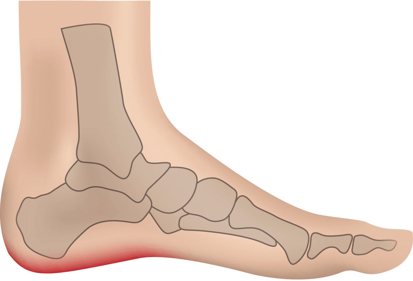 Fußgut Fersenspornhilfe »2 Paar Kissen, entlastet den Fersensporn bei Druck oder Belastung« Packung, 4 Stk. tlg. gepolsterte Vertiefung an der Unterseite entlastet, Hirschleder