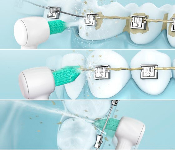 Panasonic Munddusche »EW1513«, 2 St. Aufsätze}, kabellose Munddusche mit orthodontischer Düse