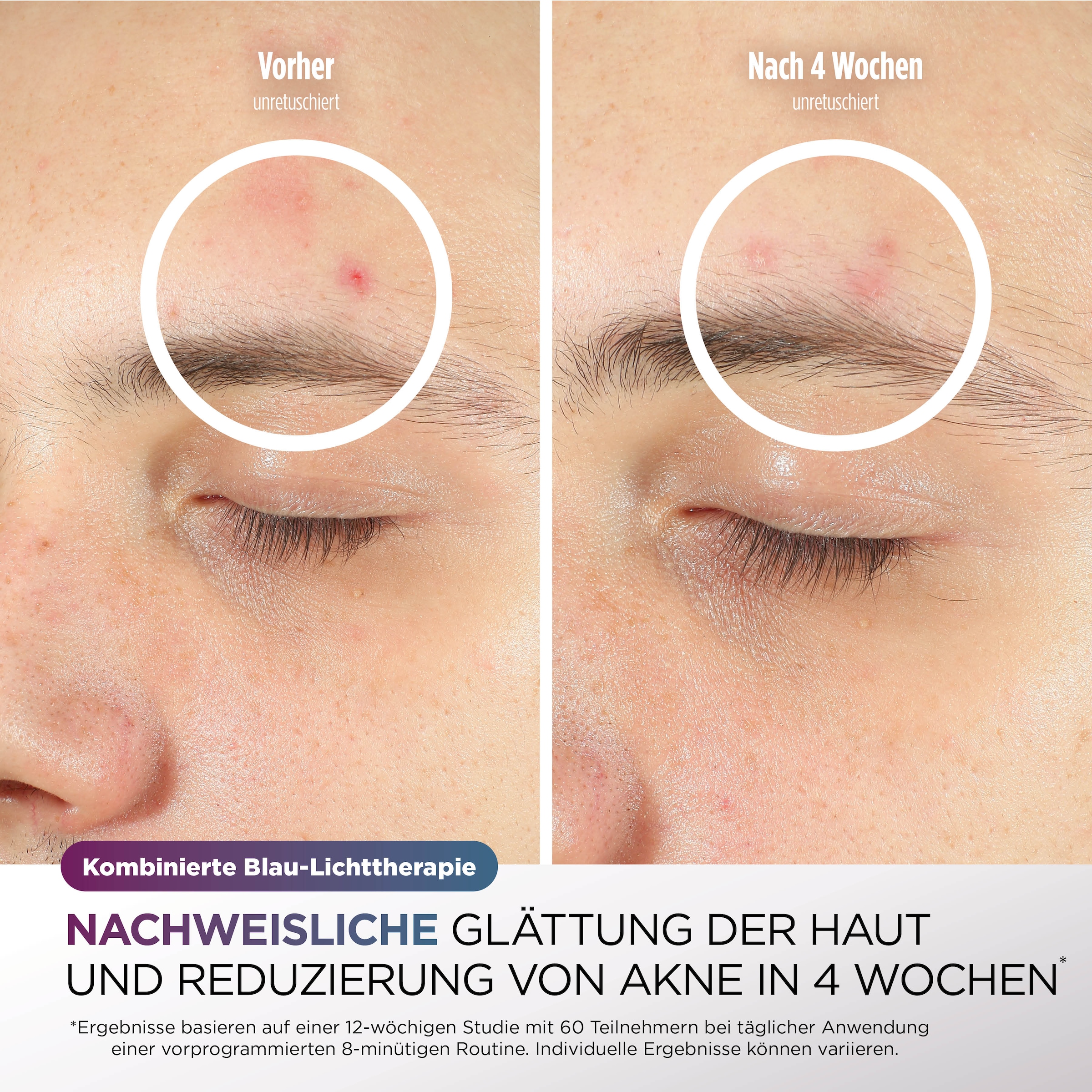 Shark LED-Gesichtsmaske »Shark CryoGlow LED-Maske + Kühlung der Augenpartie FW312EUPL« CryoGlow - unsere neue medizinisch zertifizierte Innovation