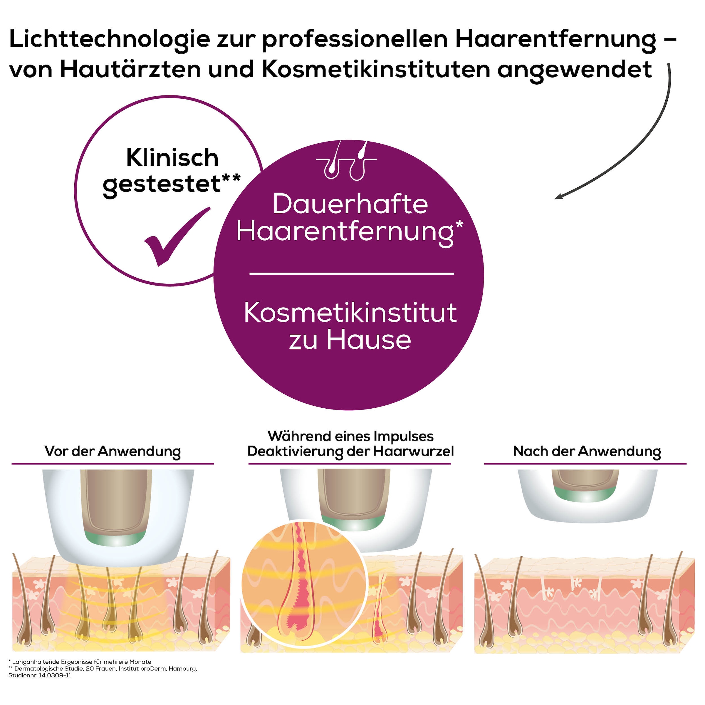 BEURER IPL-Haarentferner »IPL 8500 für langanhaltende Haarentfernung durch Lichttechnologie«, 300000 Lichtimpulse, Kraftvolles Akkugerät für eine flexible, kabellose Anwendung