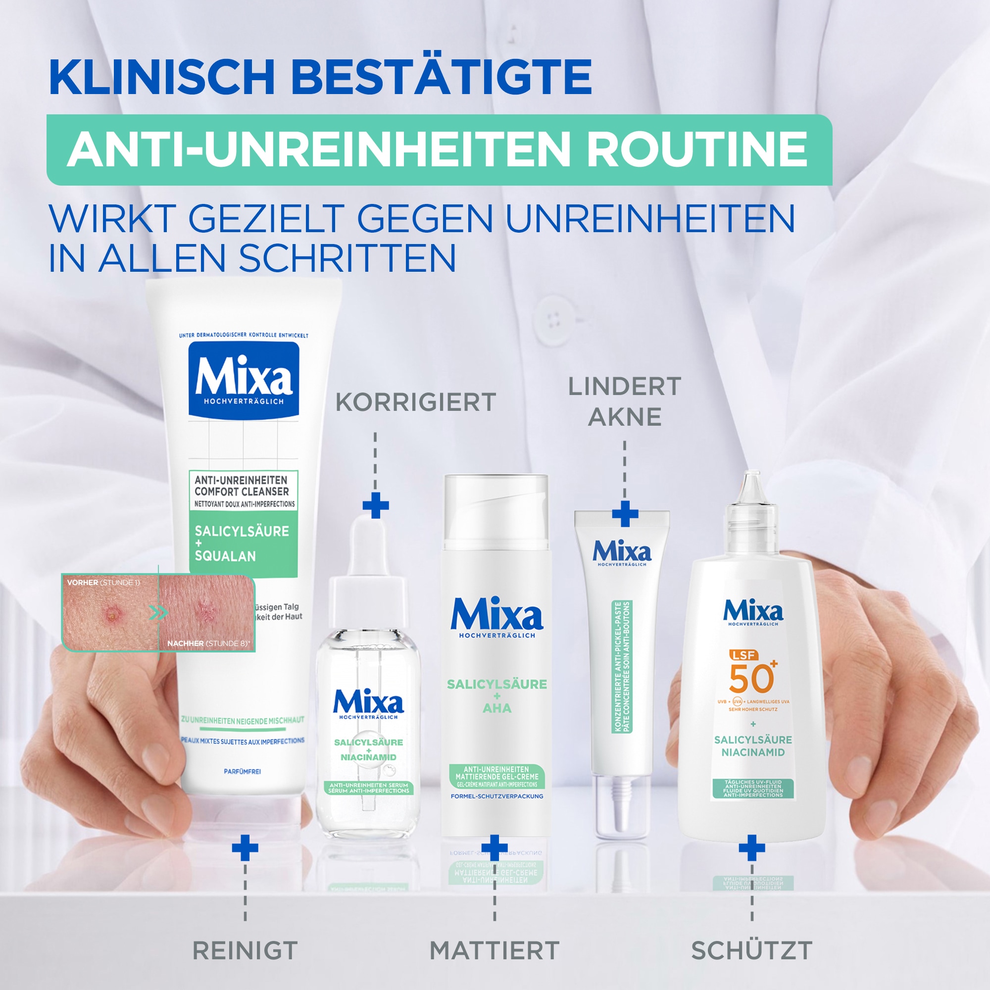 Mixa Gesichts-Reinigungscreme »MIXA KONZENTRIERTE ANTI-PICKEL PASTE« mit Niacinamid