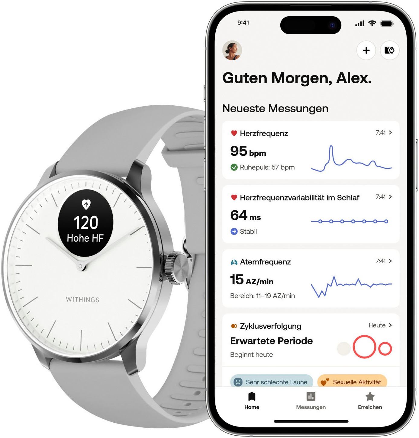 Withings Smartwatch »ScanWatch Light 37mm RoseGold, Akku bis 30 Tage, 50 M Wasserdicht«, (/ 0,63 Zoll), Leicht, elegant, langlebig, hybride, für tägliches Gesundheitstracking