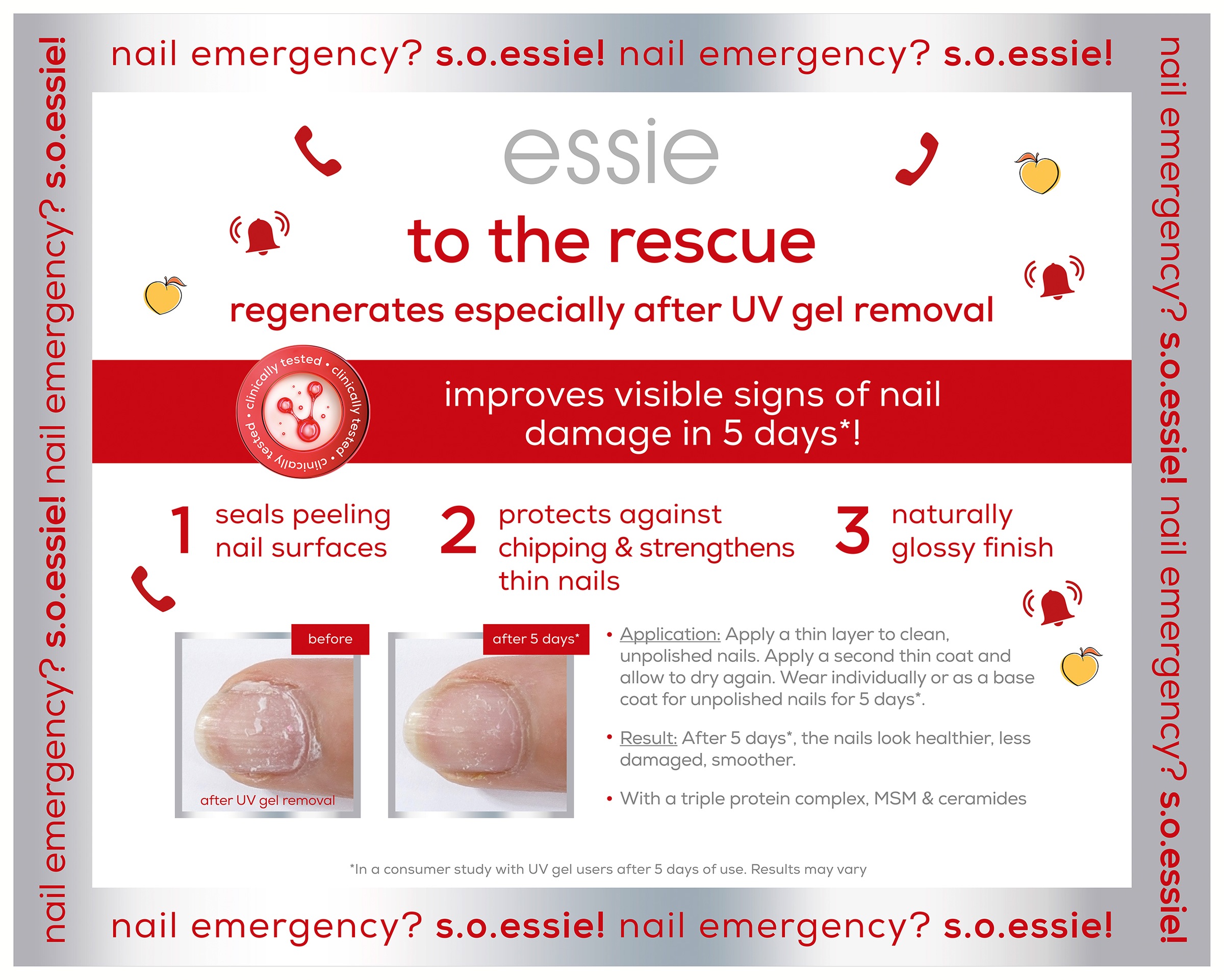 essie Nagelhautpflege »Essie nail rescue Kit«