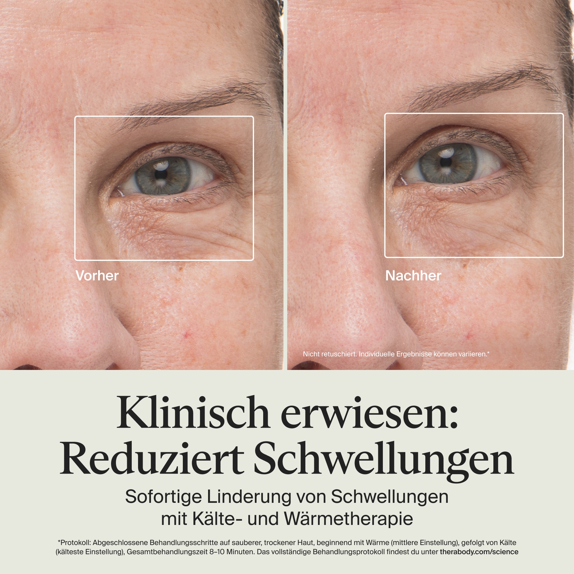 Therabody Anti-Aging-Gerät »Theraface Depuffing Wand Kälte- und Wärmebehandlungen für das Gesicht«, Verbessert die Strahlkraft, reduziert Augenringe und Schwellungen