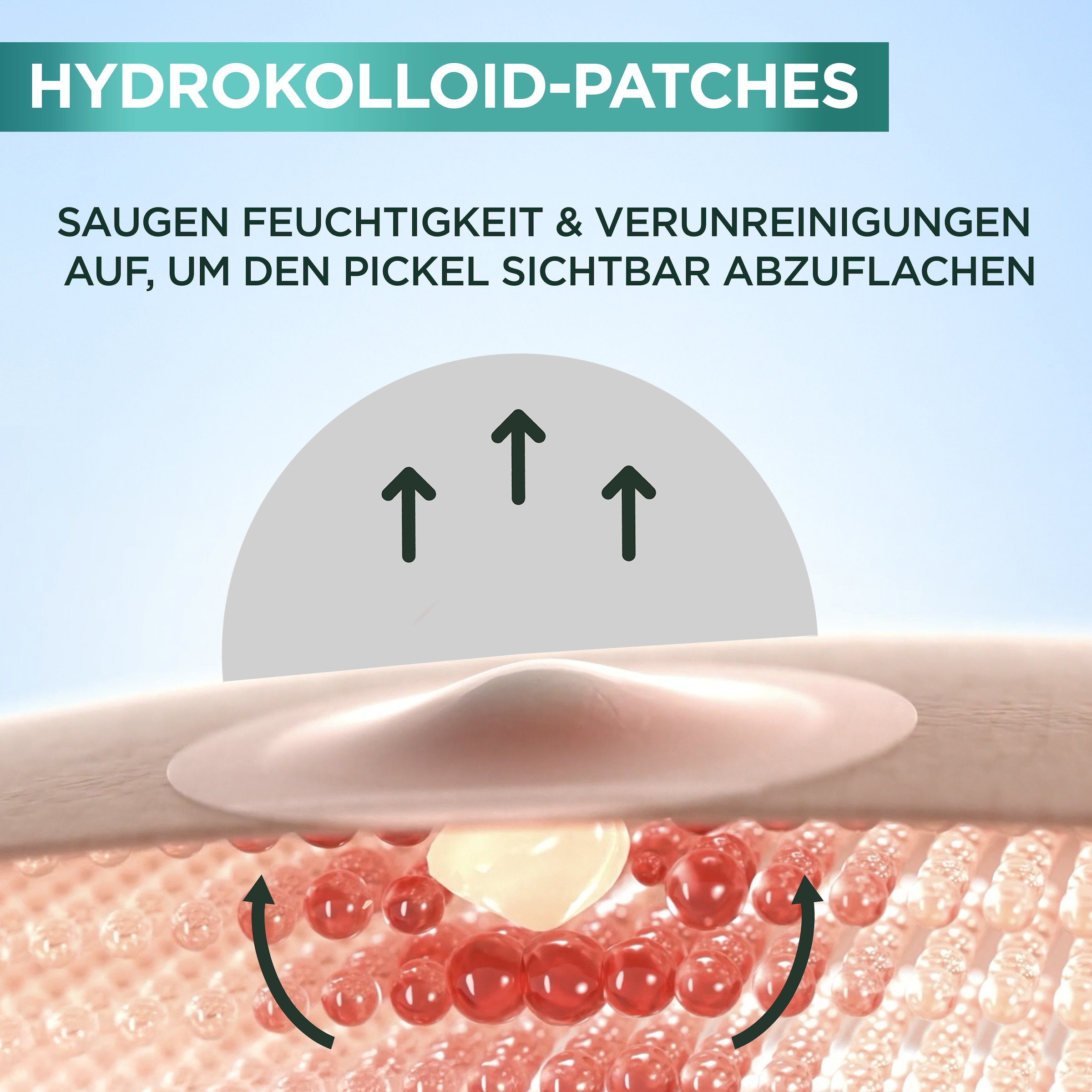 GARNIER Pflegestift »Garnier 8H Invisible Pimple Patch«, Flacht Pickel ab mit Hydrokolloid, keine Pickelmale.