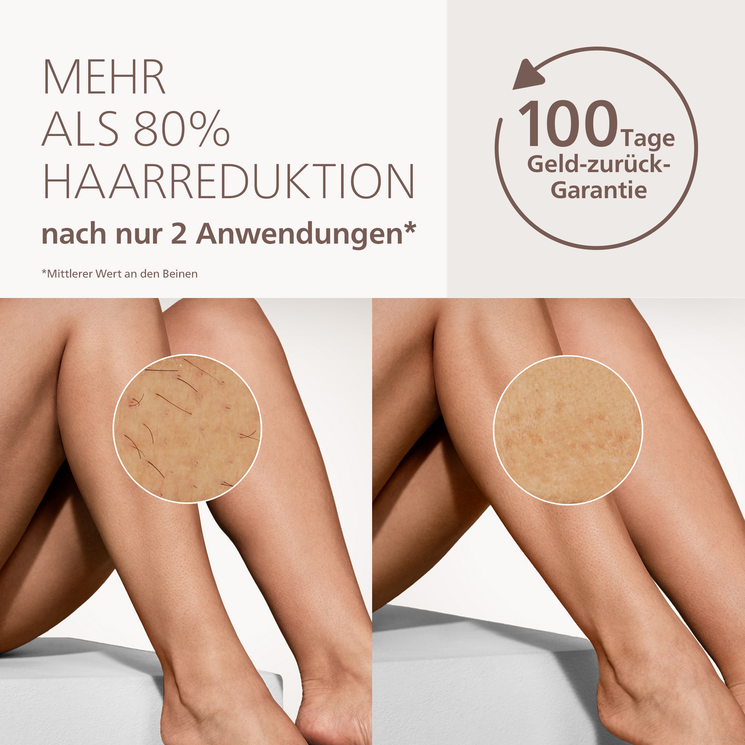Philips IPL-Haarentferner »Philips Lumea Series 8000 BRI934/00« 2 Aufsätze (Gesicht, Körper)