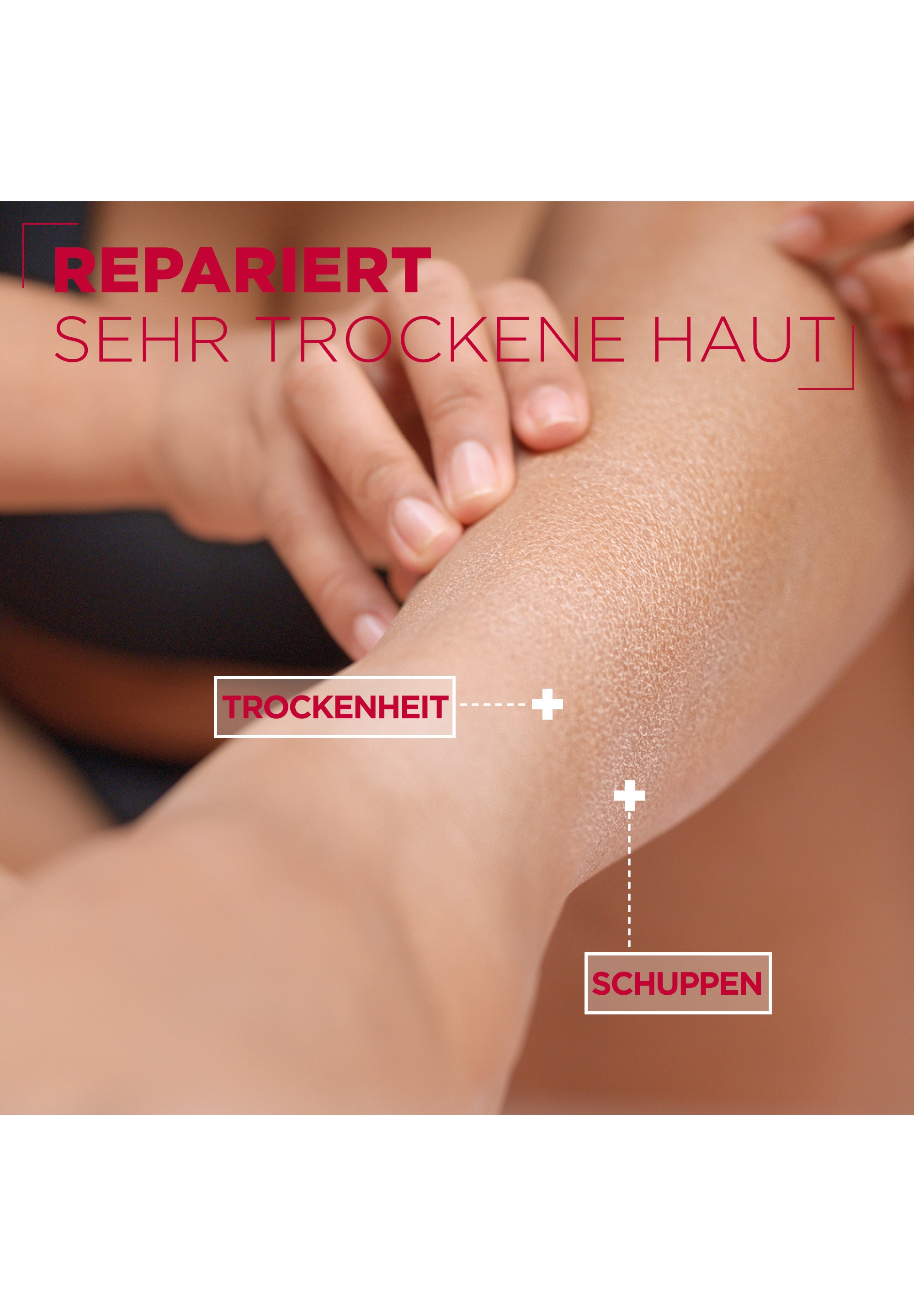 Mixa Körpermilch »MIXA UREA CICA REPAIR + BODY MILK« intensive Pflege von trockener Haut