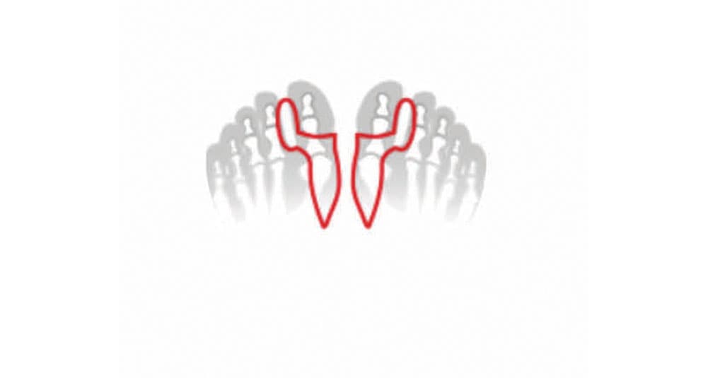 Fußgut Zehenkorrektor »Hallux Korrektor mit Ballensschutz, angenehm weich aus Softgel« hält die große Zehe auf Abstand, reduziert Reibung, mediz. Gel