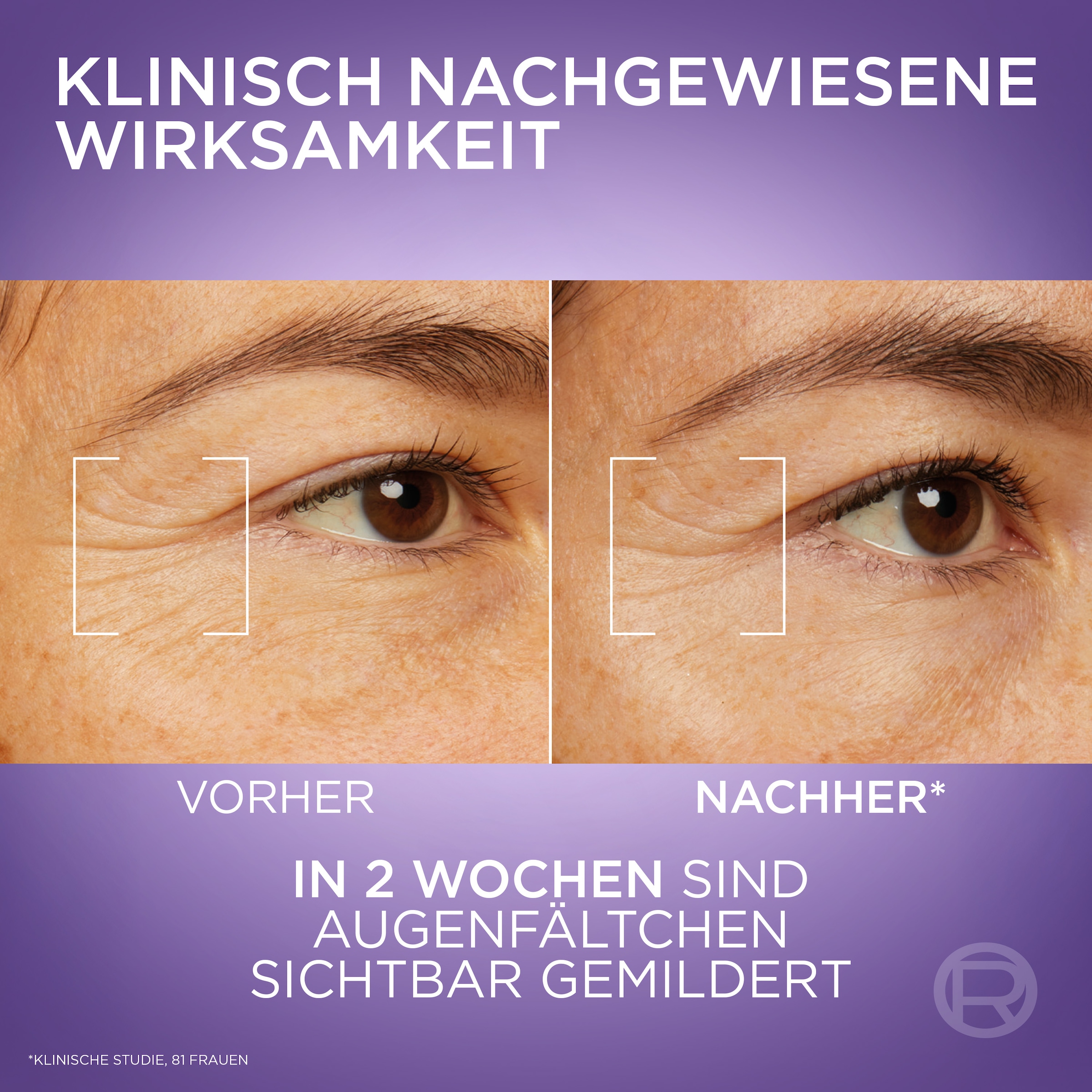 L'ORÉAL PARIS Augenserum »REVITALIFT FILLER AUGENSERUM« mit 1,5% purer Hyaluronsäure und 1% Koffein