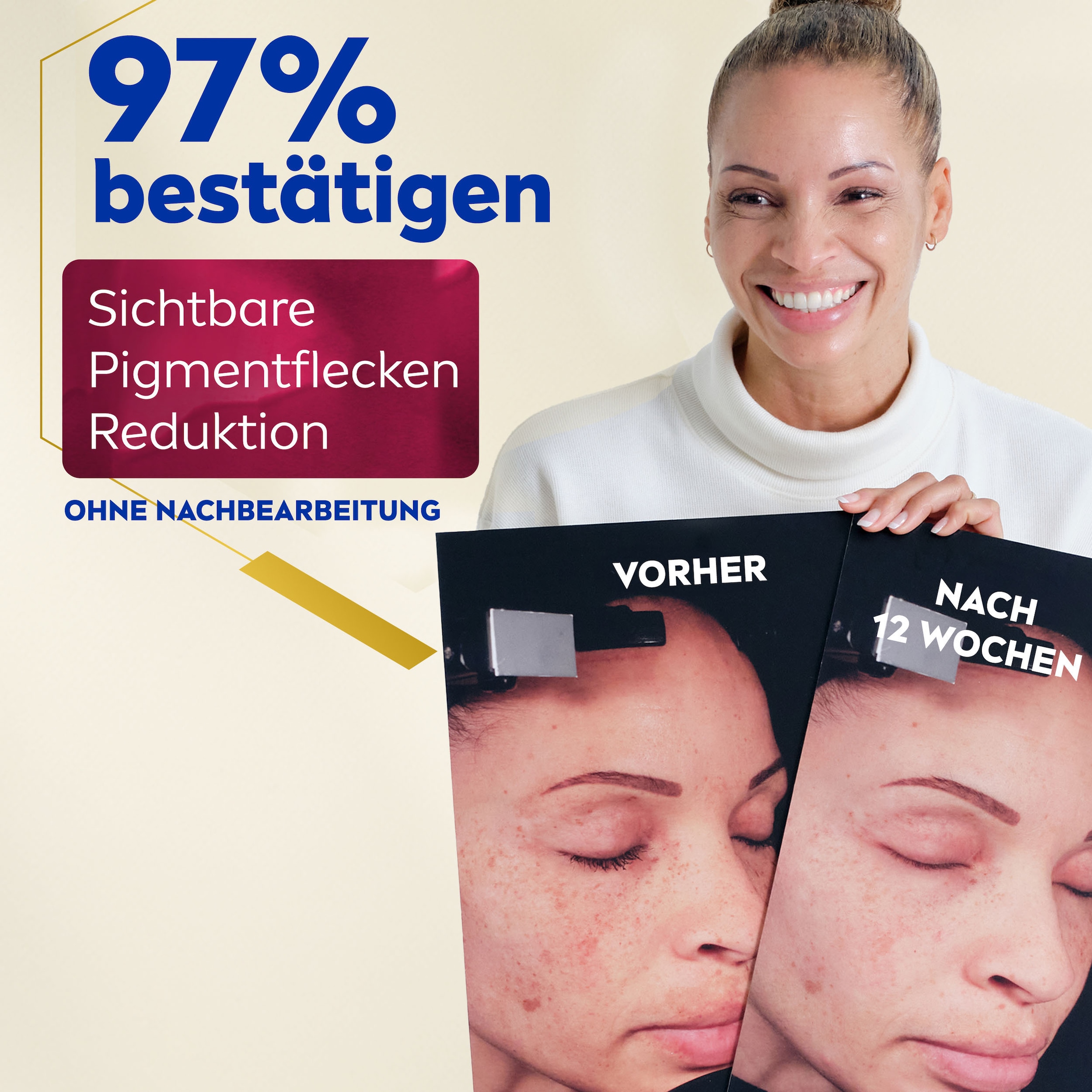 Nivea Gesichtsserum »LUMINOUS630 Anti-Pigmentflecken & Altersflecken Serum«