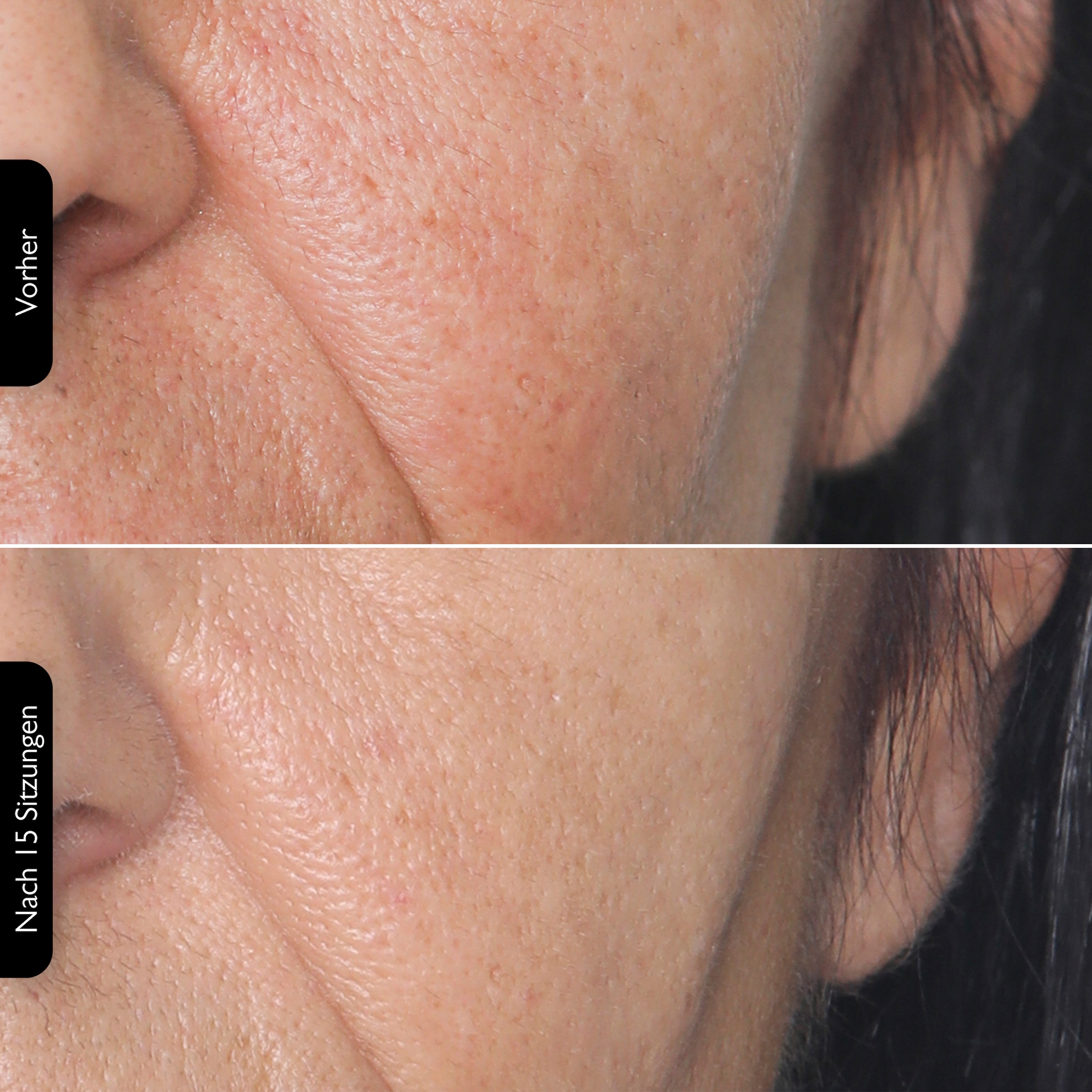 Silk'n Anti-Aging-Gerät »FaceTite Multiplatform«, Multifunktionsfähig