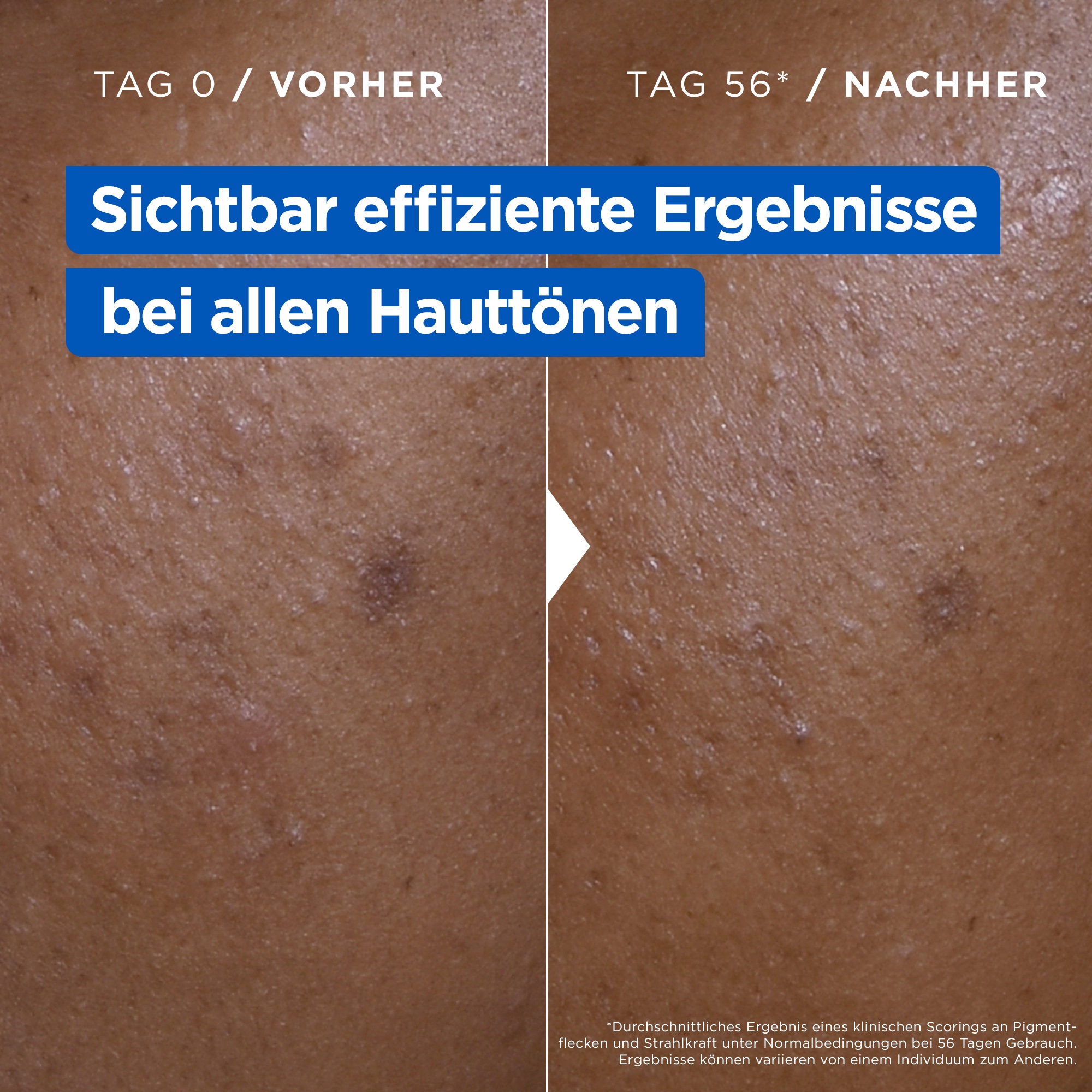 Mixa Körpermilch »Mixa Niacinamide Bright Creme« Mildert sonnenbedingte Pigmentflecken, versorgt trockene Haut.