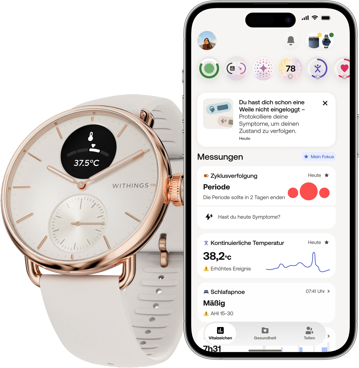 Withings Smartwatch »ScanWatch 2 38mm Rose Gold Blue« ( ) HealthSenseOS