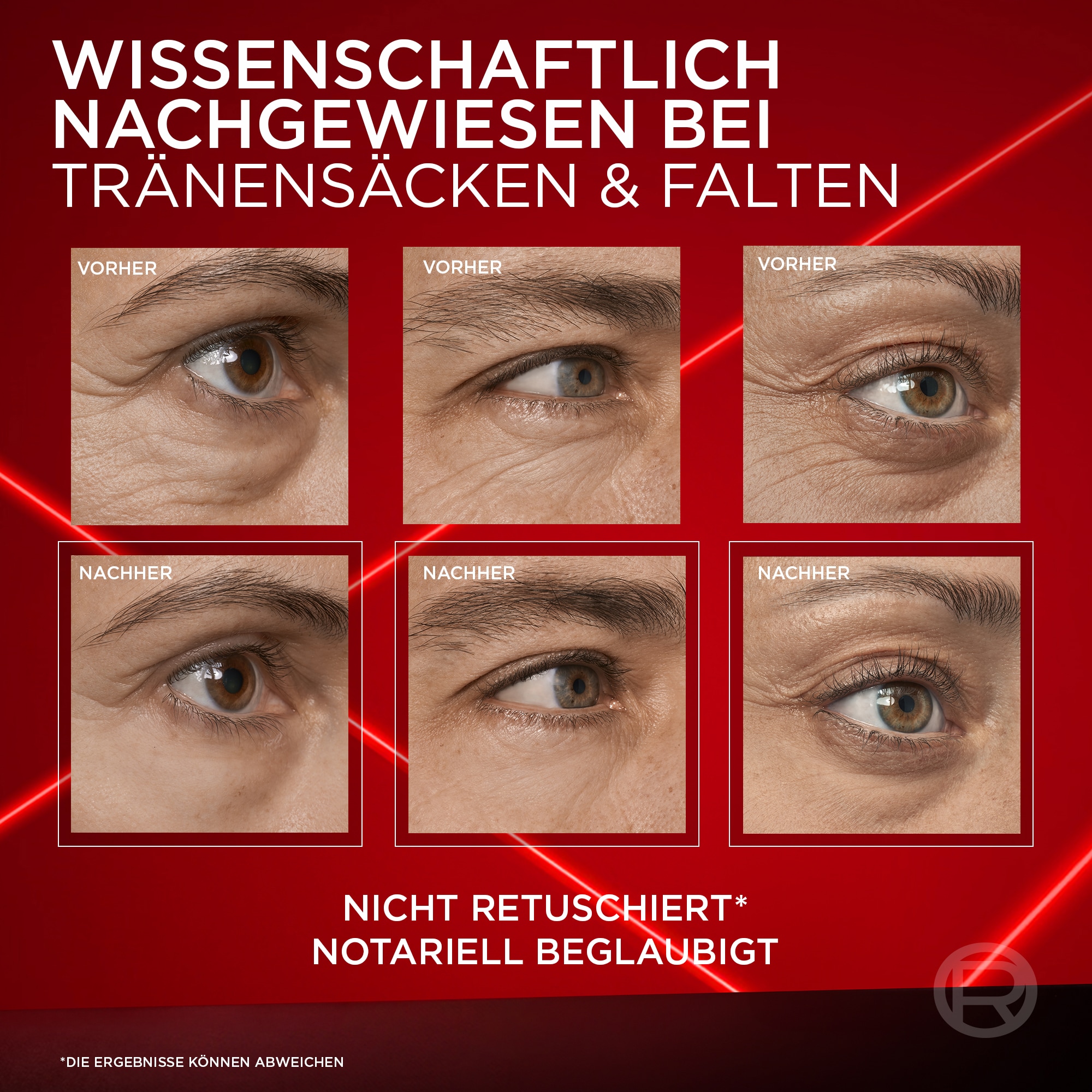 L'ORÉAL PARIS Anti-Aging-Augencreme »Revitalift Laser Anti-Tränensack Sofort Lifting«