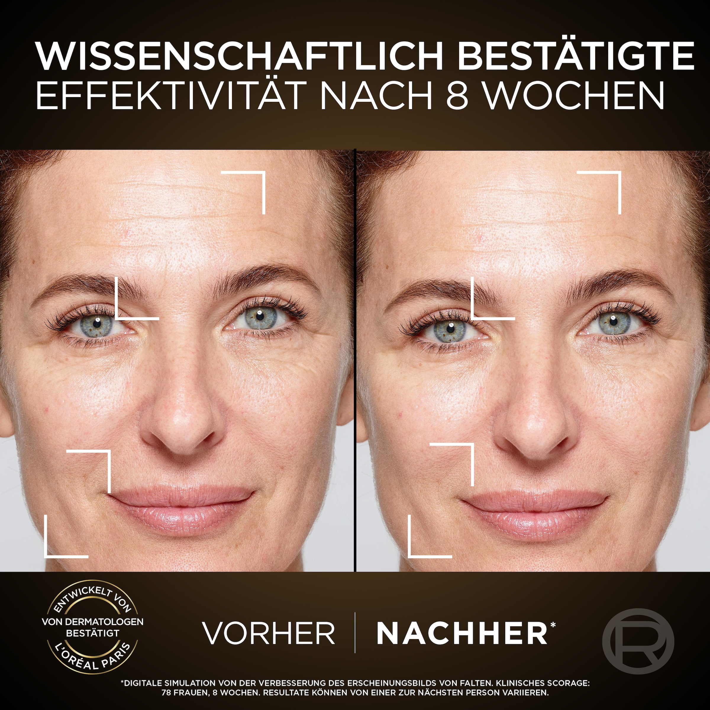 L'ORÉAL PARIS Gesichtspflege-Set »L'Oréal Paris Age Perfect Zell-Renaissance Tag & Nacht Set«