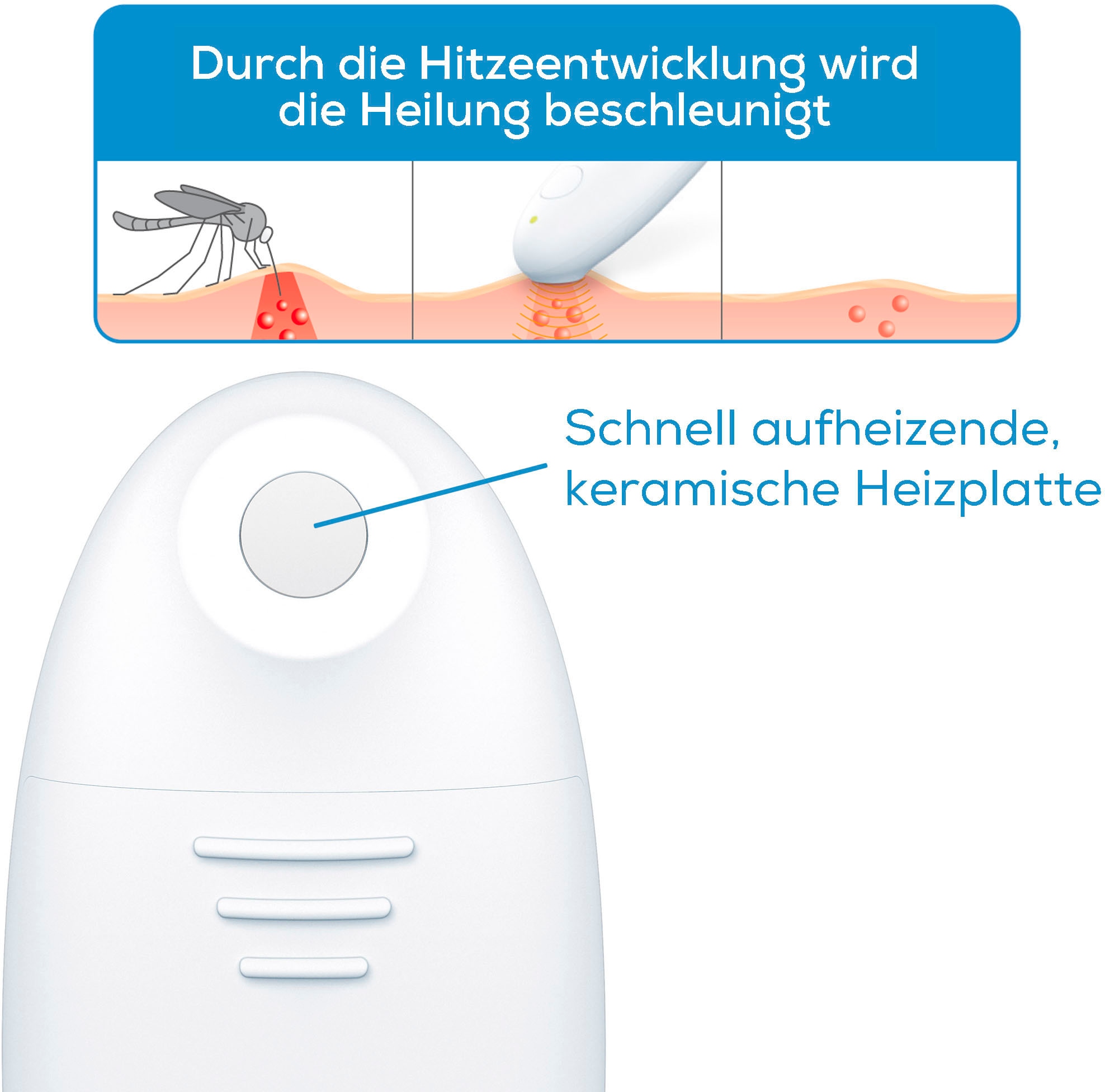 BEURER Insektenstichheiler »BiteX 10 Travel« Lindert Juckreiz u. Schwellungen, klein & handlich