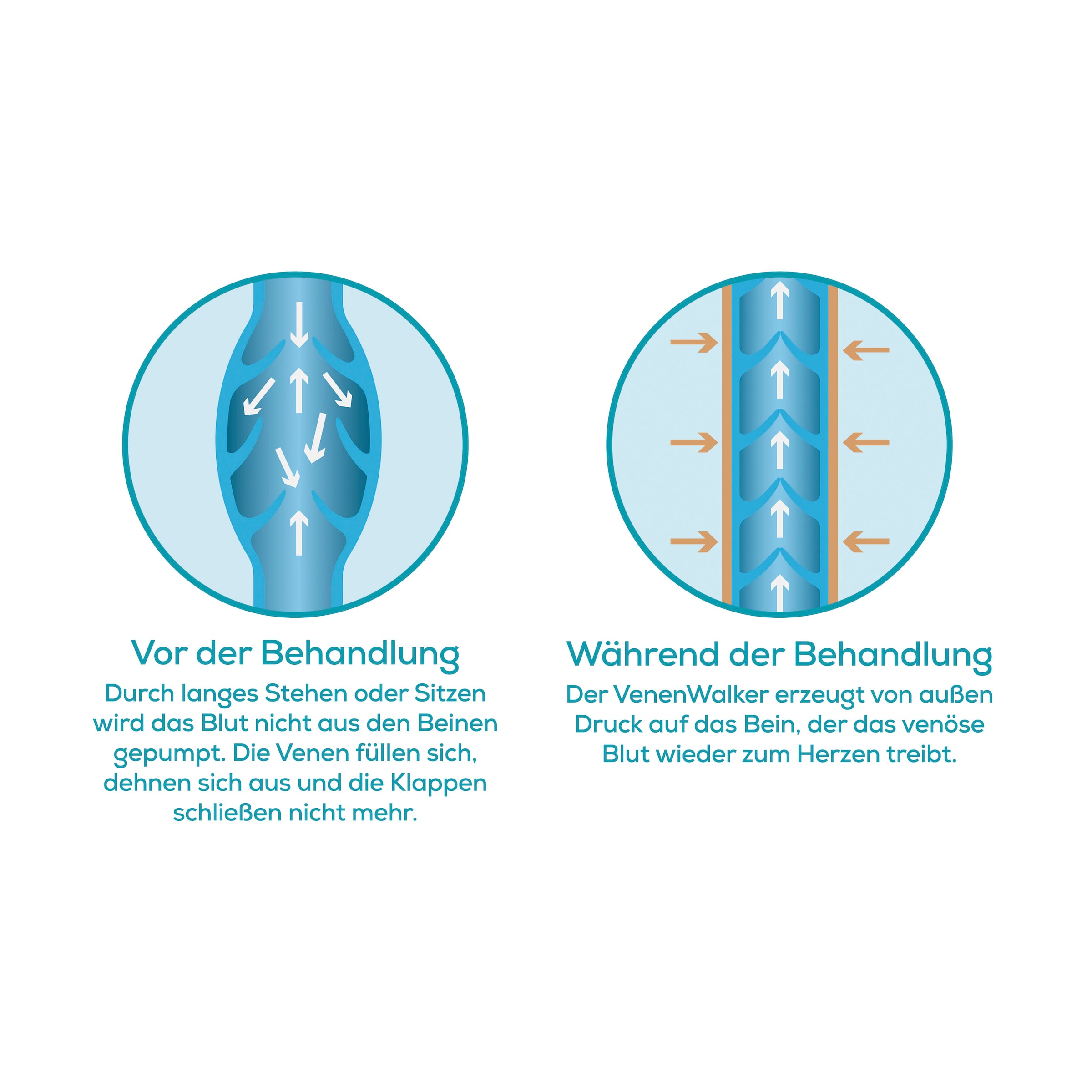 VENENWALKER basic Venentrainer »VenenWalker Basic«, (Set, 5 tlg., 1* Steuergerät, 1* Tragetasche, 2* Beinmanschetten, 1*Netzadapter)
