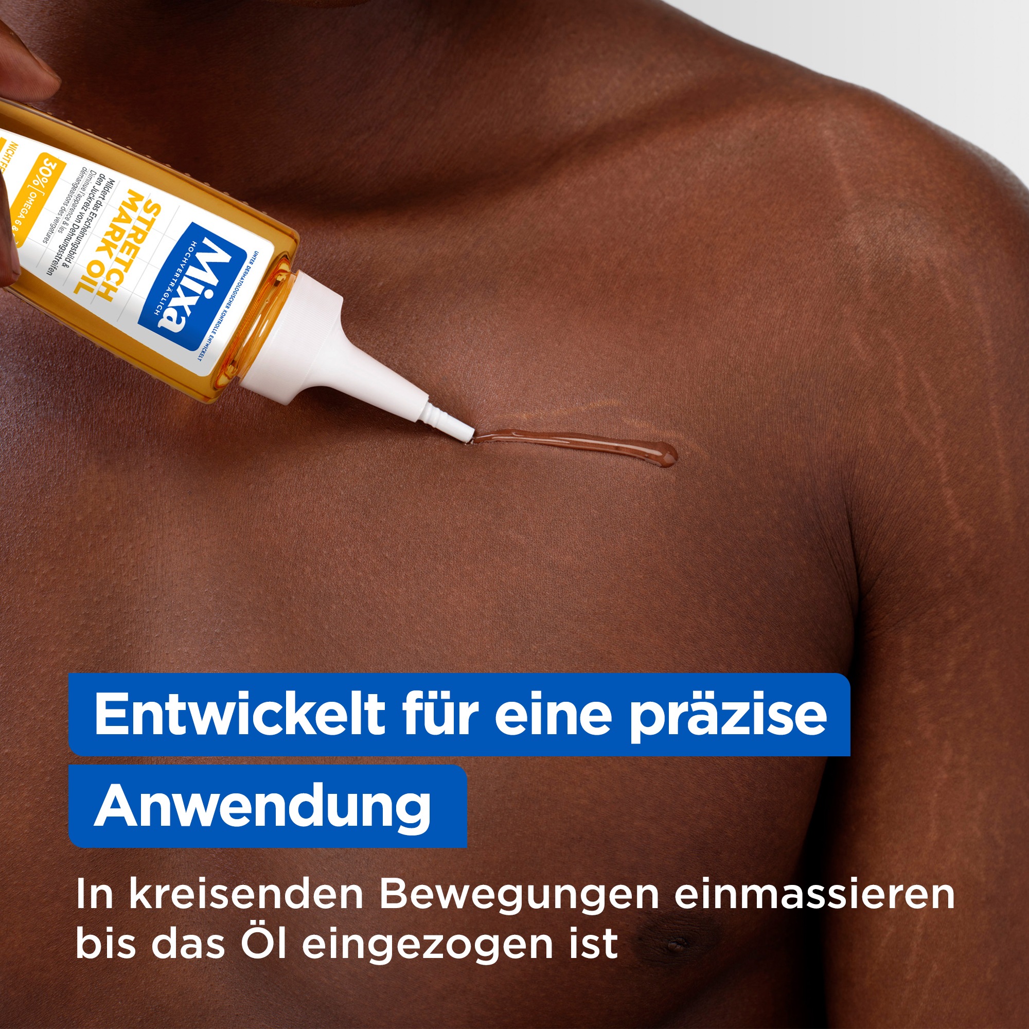 Mixa Körperlotion »Mixa Niacinamide Stretchmark Oil«, Mindert Dehnungsstreifen und deren Juckreiz, für empfindliche Haut.